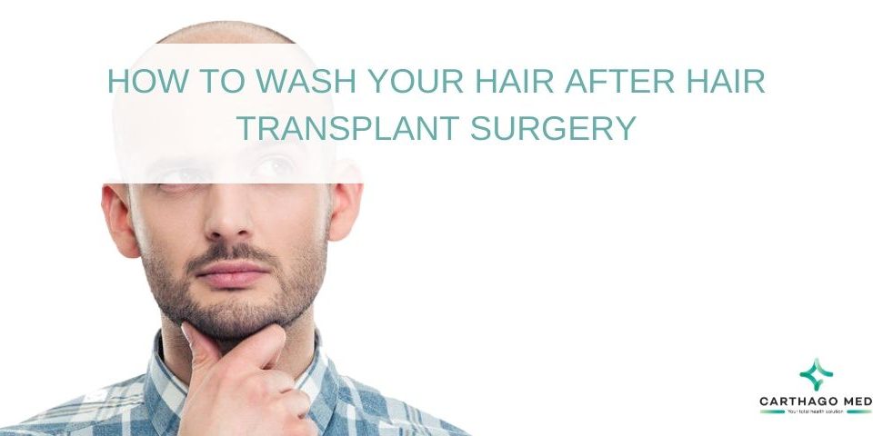 wash your hair after hair transplant