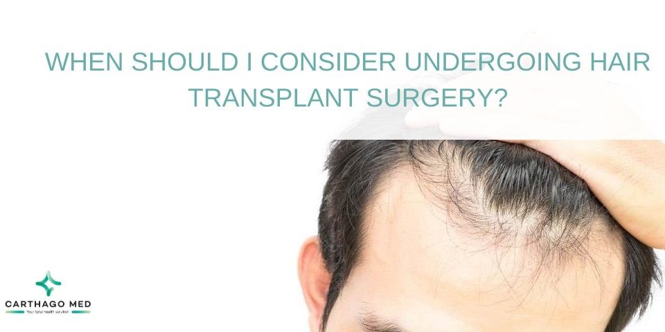 Hair Transplant Surgery Timing