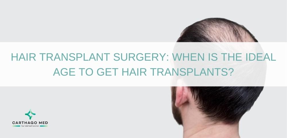 What is The Best Age For Hair Transplantation Surgery?