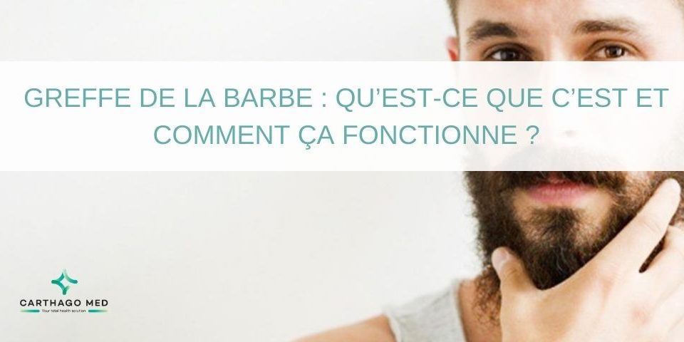 Greffe de la barbe