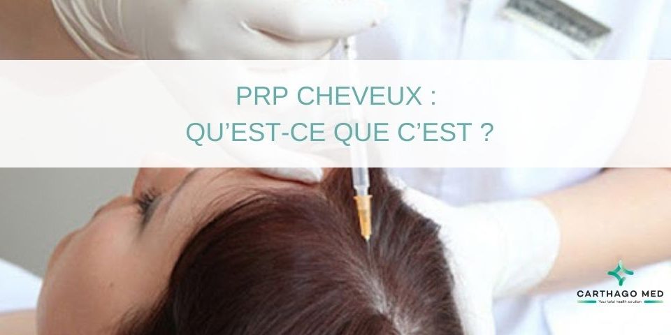 PRP cheveux