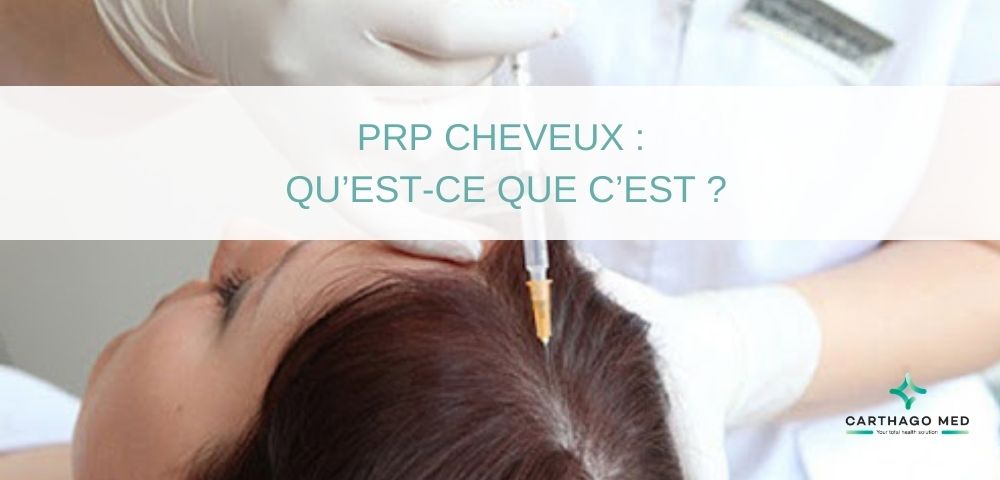 PRP cheveux