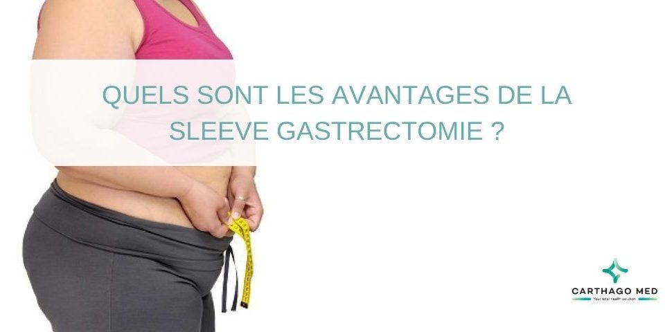 Quels sont les avantages de la sleeve gastrectomie ?