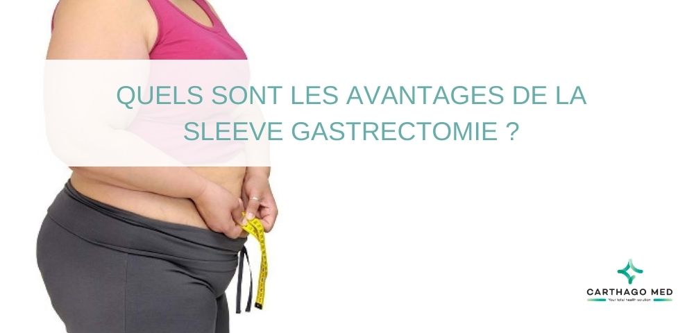 Quels sont les avantages de la sleeve gastrectomie ?