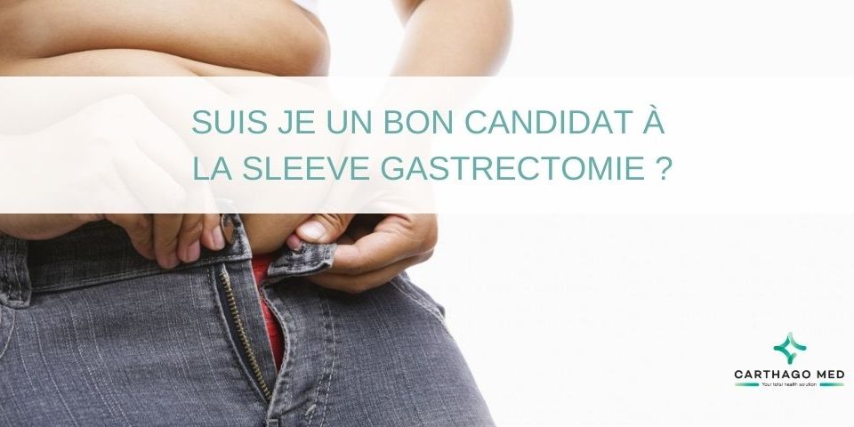 Suis-je un bon candidat à la sleeve gastrectomie