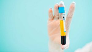 PRP-plasma-riche-plaquettes