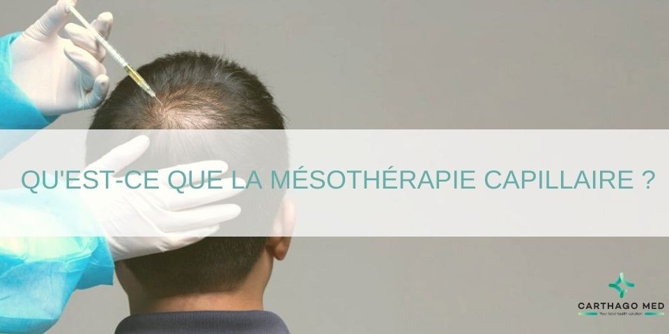 mesotherapie-cheveux