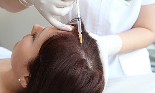 mesotherapie-cheveux