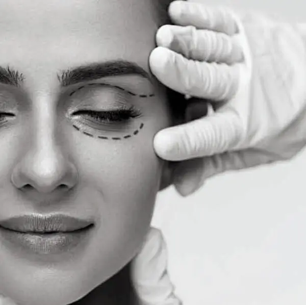 Blepharoplastie medicale