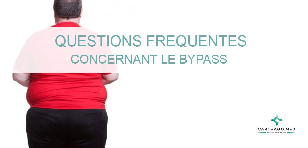 Faq concernant le bypass