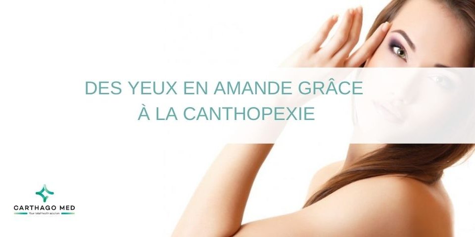 canthopexie