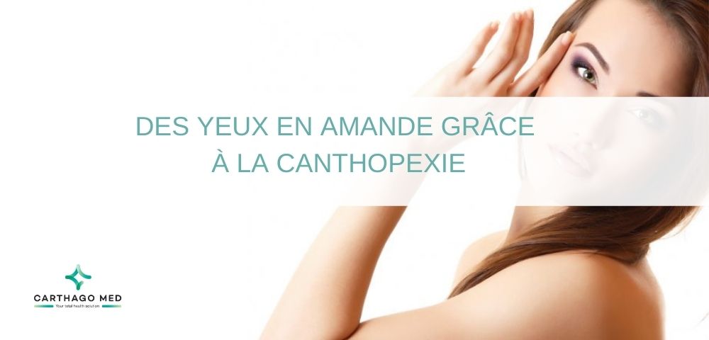 canthopexie