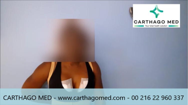 testimony carthago med