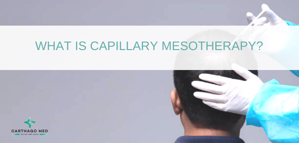 What-is-capillary-mesotherapy