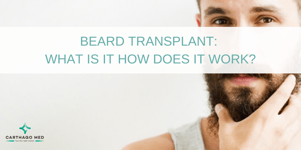 beard-transplant-what-is-it