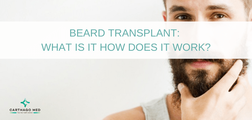 beard-transplant-what-is-it