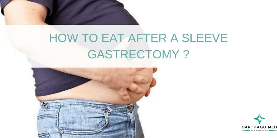 a sleeve gastrectomy