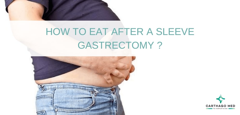 a sleeve gastrectomy