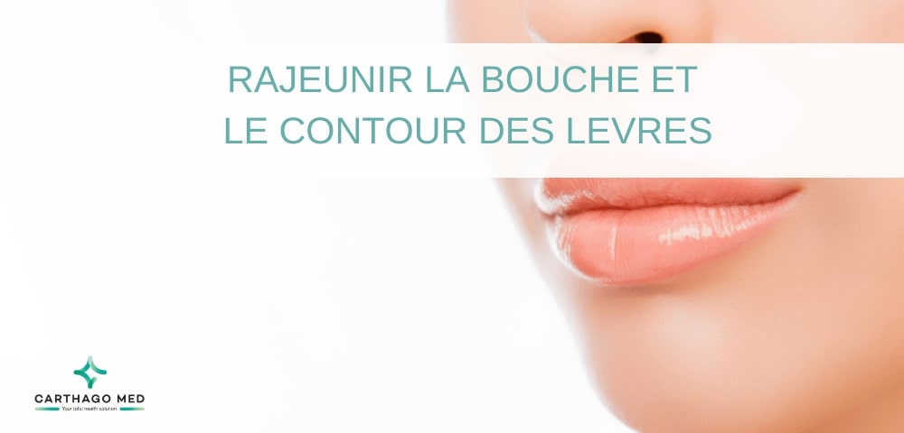 lip lift rajeunir la bouche