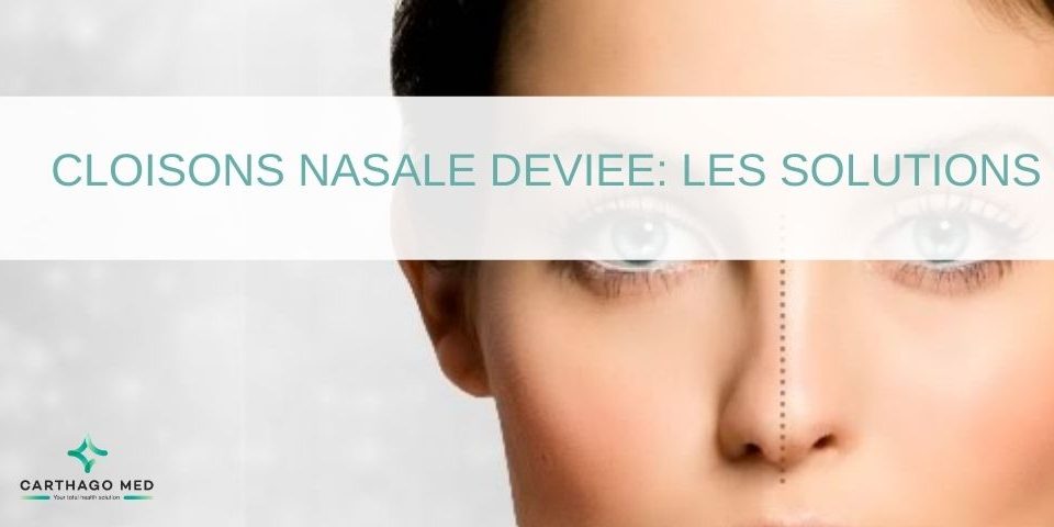 Cloison nasale-deviee