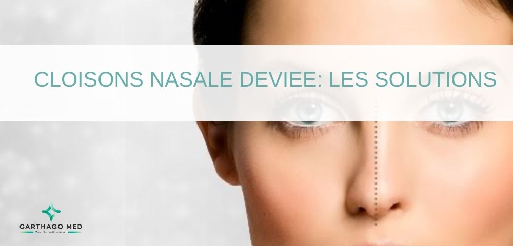 Cloison nasale-deviee