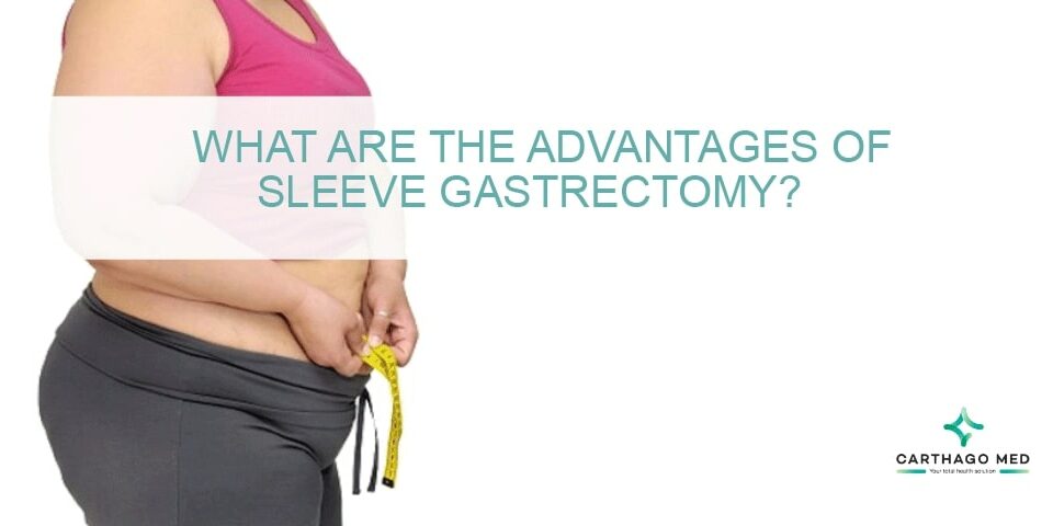 sleeve gastrectomy