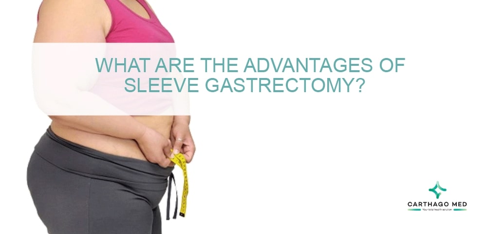 sleeve gastrectomy