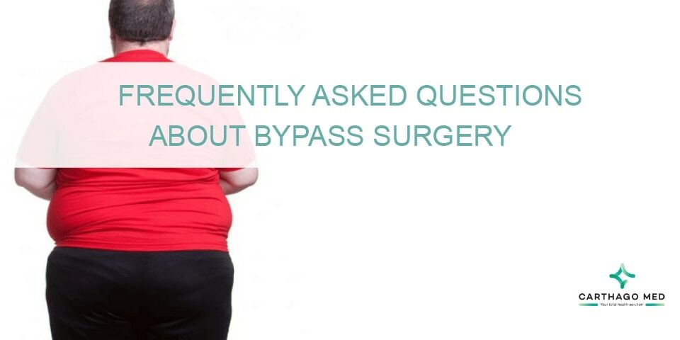 Gastric Bypass Surgery