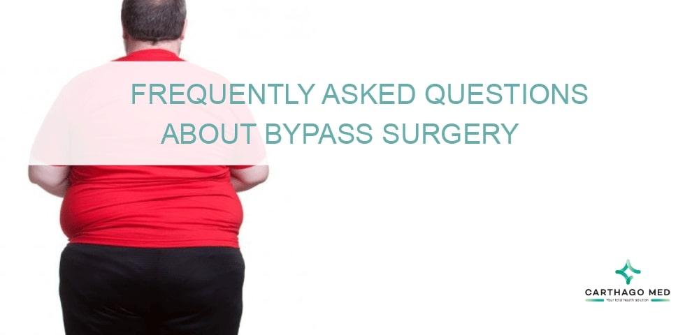 Gastric Bypass Surgery