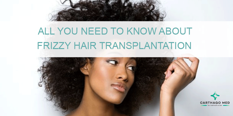 How Long Does the Transplanted Hair Last?