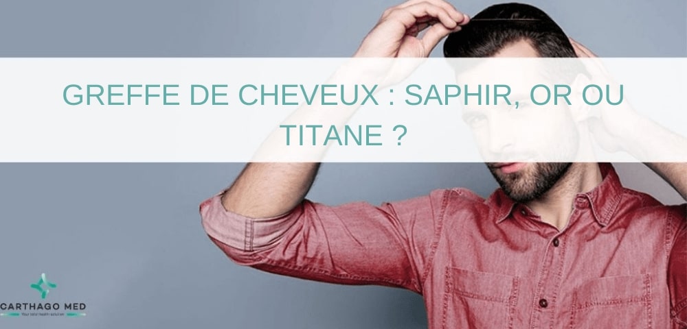 Greffe de cheveux : saphir, or ou titane ?