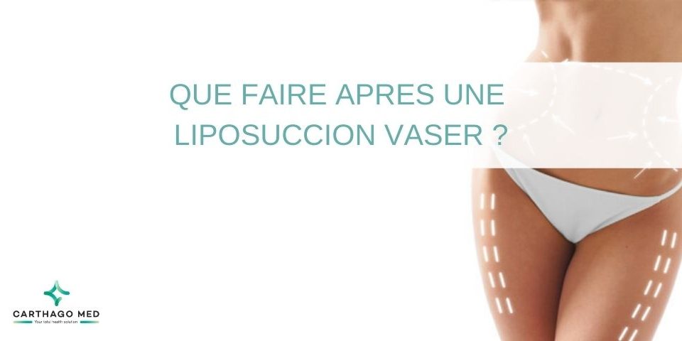 que faire apres liposuccion vaser