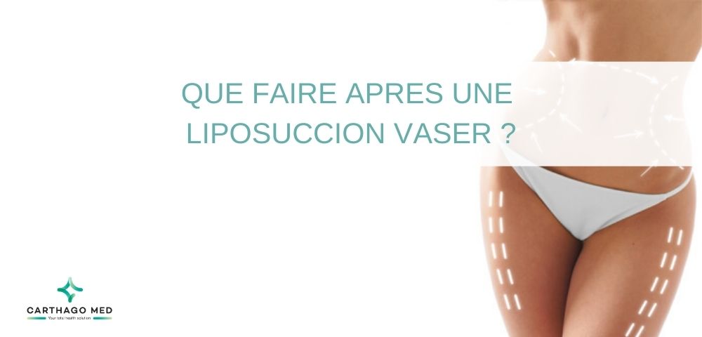 que faire apres liposuccion vaser