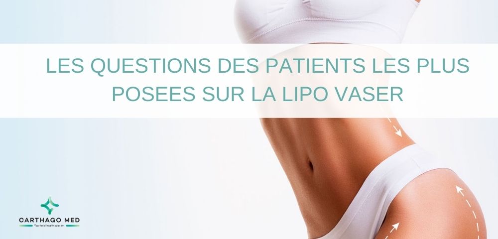 questions frequentes lipo vaser