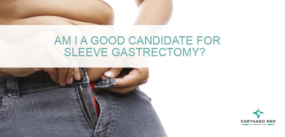 sleeve gastrectomy