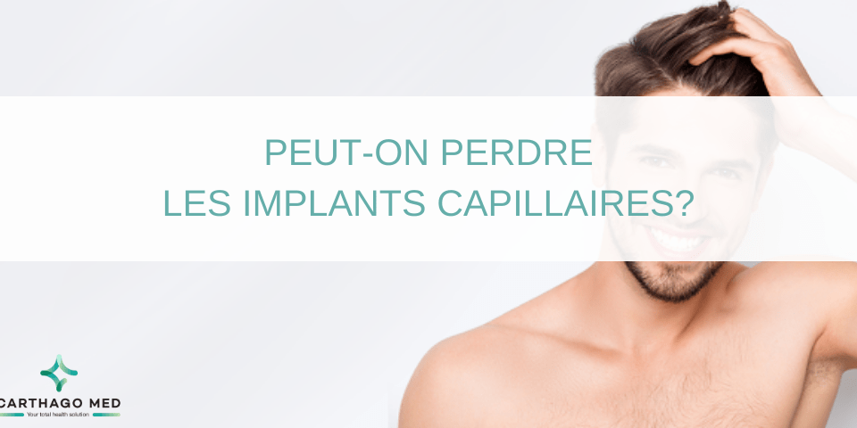 perdre les implants capillaires