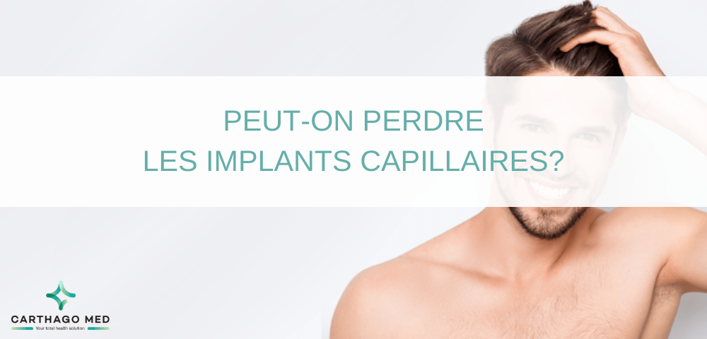 perdre les implants capillaires