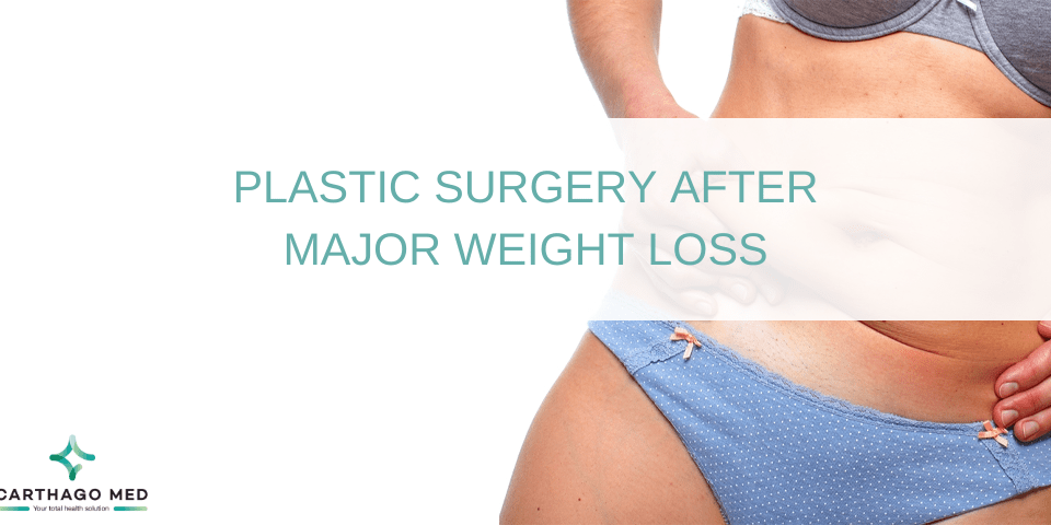 PLASTIC SURGERY AFTER MAJOR WEIGHT
