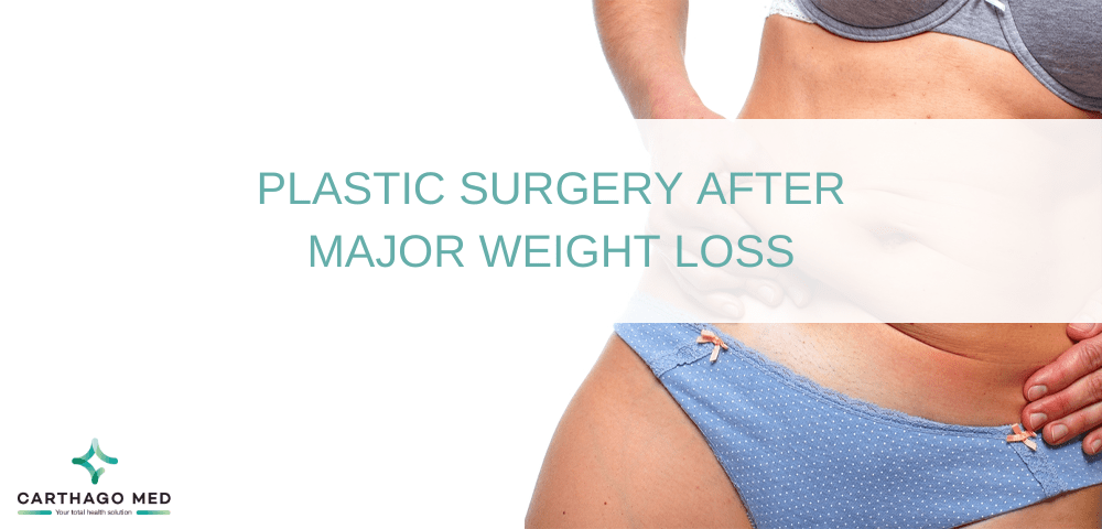PLASTIC SURGERY AFTER MAJOR WEIGHT