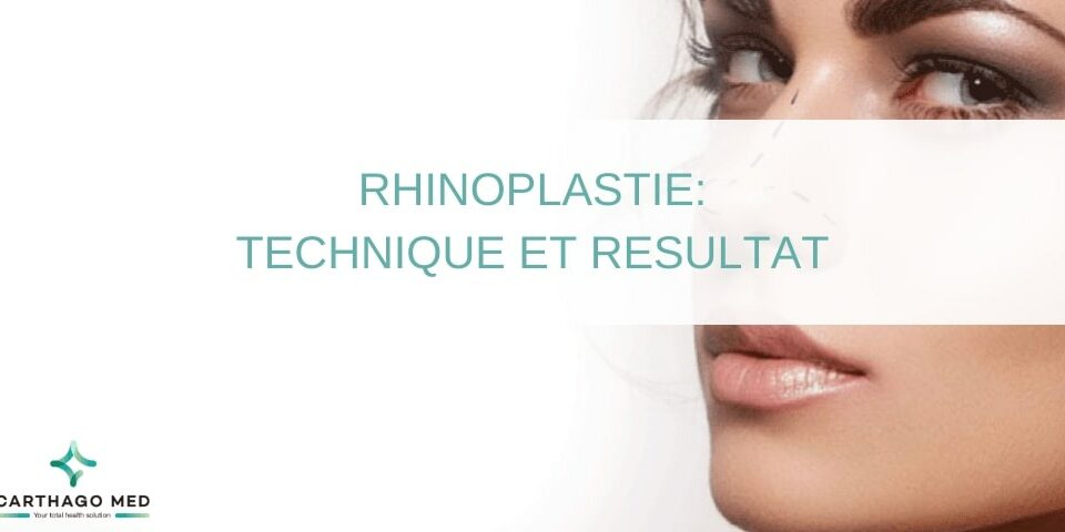 technique rhinoplastie