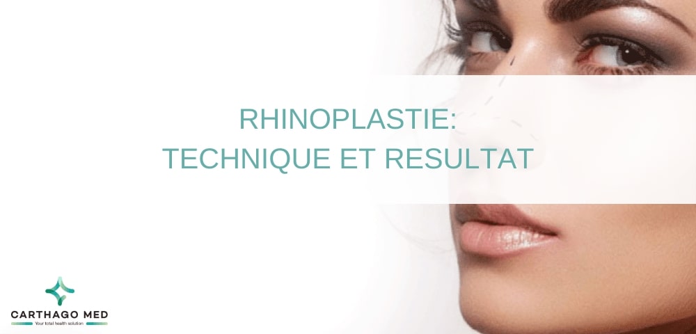 technique rhinoplastie