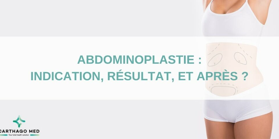 Abdominoplastie, indication, résultats