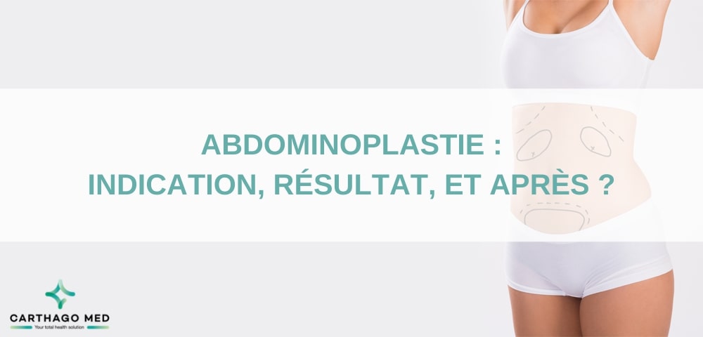 Abdominoplastie, indication, résultats