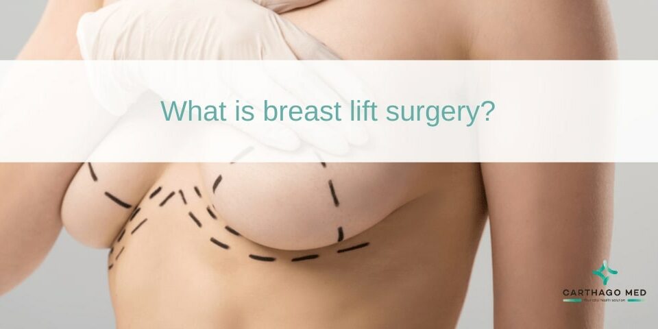 breast lift surgery