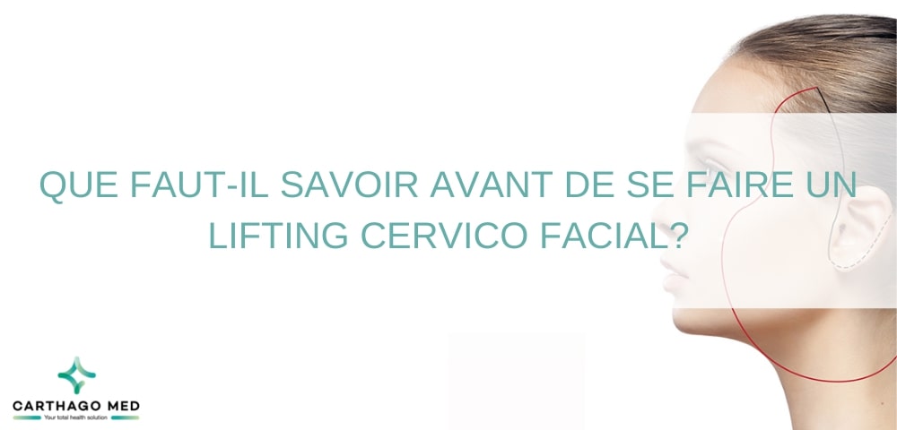 Que faut il savoir avant de se faire lifting cervico-facial