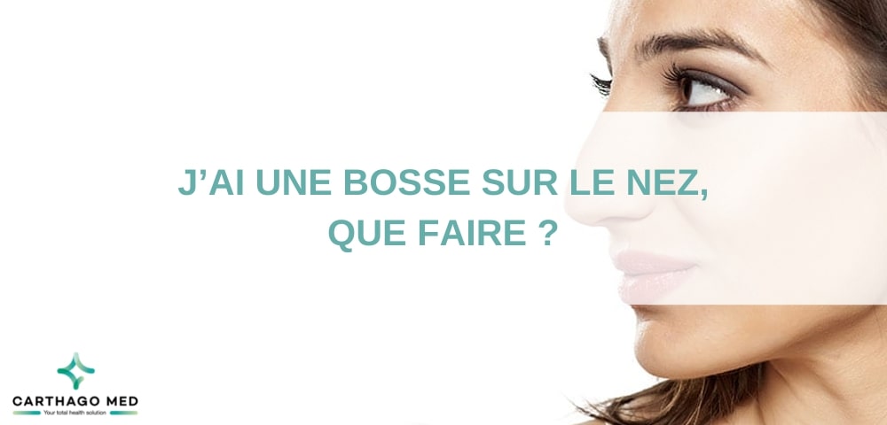 Conseils et Solutions : Comment Traiter une Bosse sur le Nez