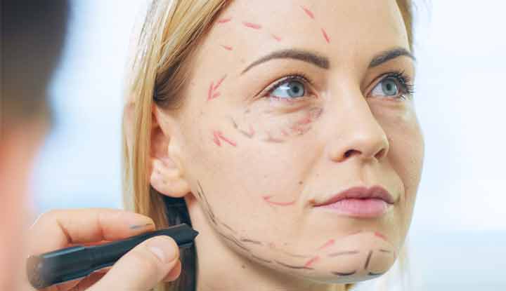 Facial rejuvenation surgery