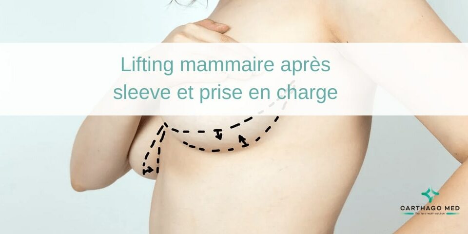 lifting mammaire après sleeve