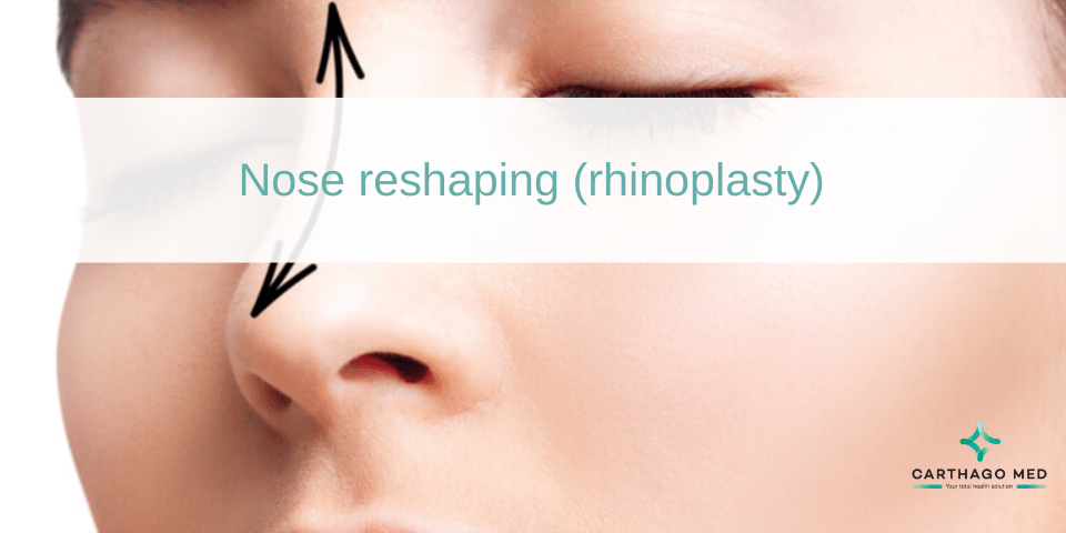 Nose reshapine : rhinoplasty