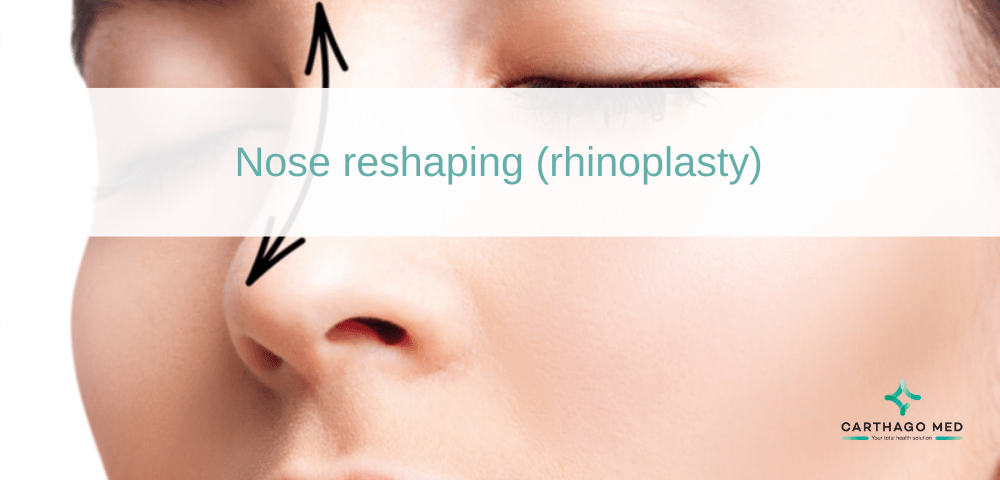Nose reshapine : rhinoplasty